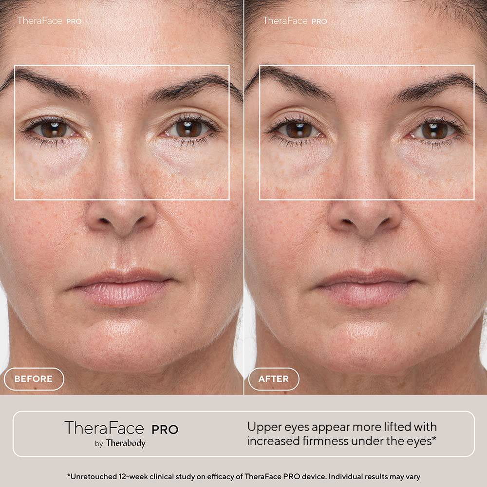 Masajeador facial Therabody Theraface Pro para terapia y cuidado de la piel - Achorao